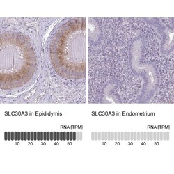 SLC30A3 Antibody, Novus Biologicals 25 &mu;L | Buy Online | Novus Biologicals | Fisher Scientific